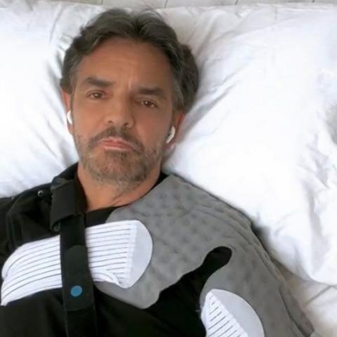 Eugenio Derbez se recupera de las fracturas que sufrió en el hombro