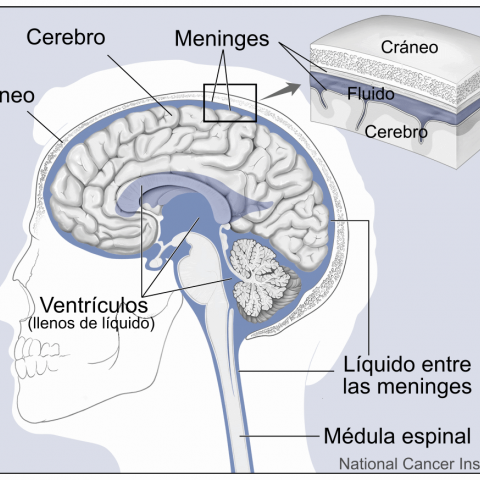 Cerebro