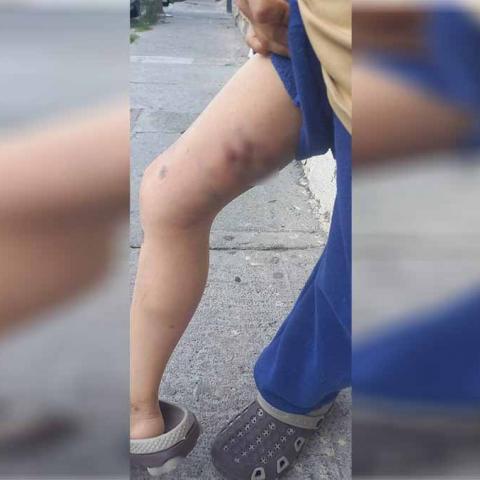 Gracias a una denuncia en redes sociales, los policías detuvieron a los padres del menor, vecinos de la Colonia Insurgentes