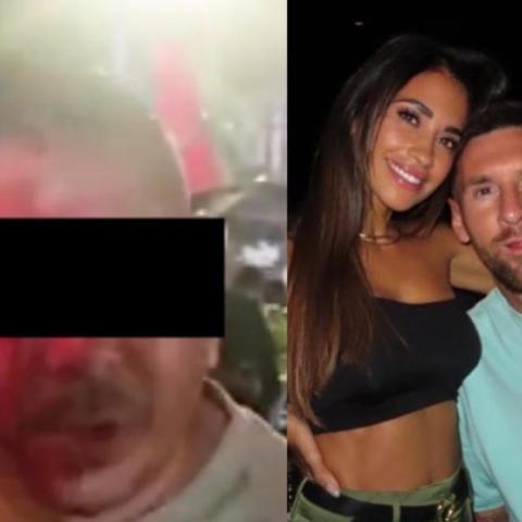 Golpean a hombre por supuesta foto