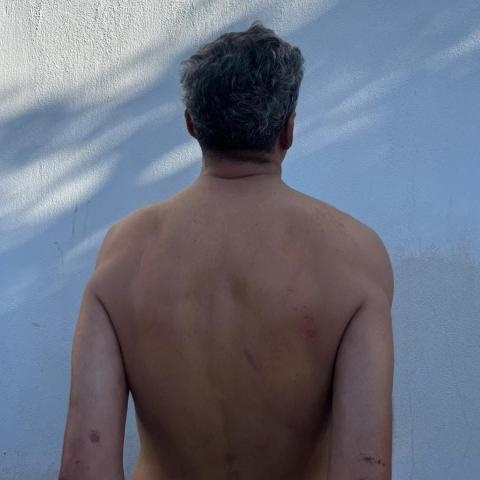agresivo