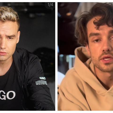 Liam Payne se encuentra hospitalizado por problemas renales