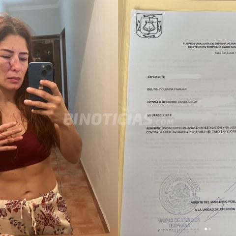 Exseleccionada nacional de lucha denuncia agresiones de su pareja, peleador de MMA.