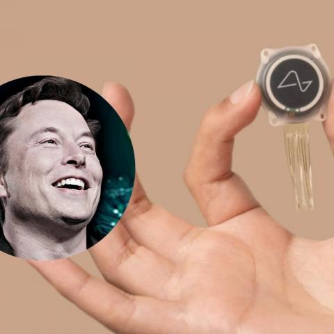 Implantan con éxito el primer chip cerebral Neuralink de Elon Musk