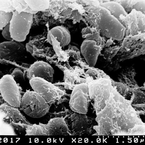 Yersinia pestis