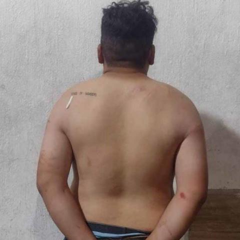intoxicado