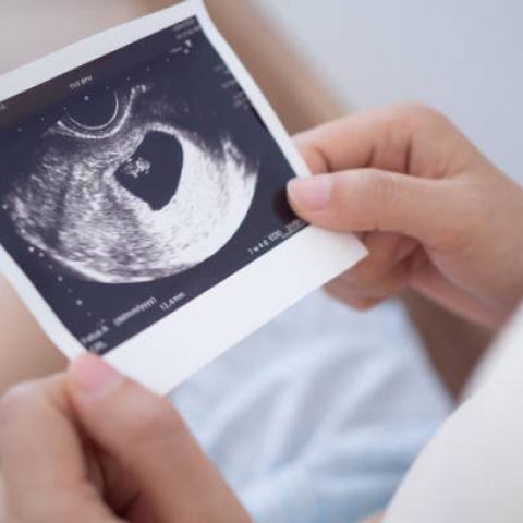 “El incremento de embarazos no deseados en temporada de Feria es un mito”, asegura el ISSEA
