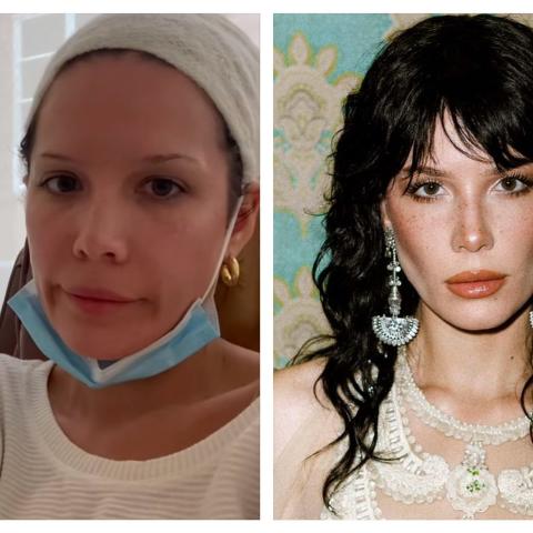 La cantante Halsey revela que padece lupus y leucemia