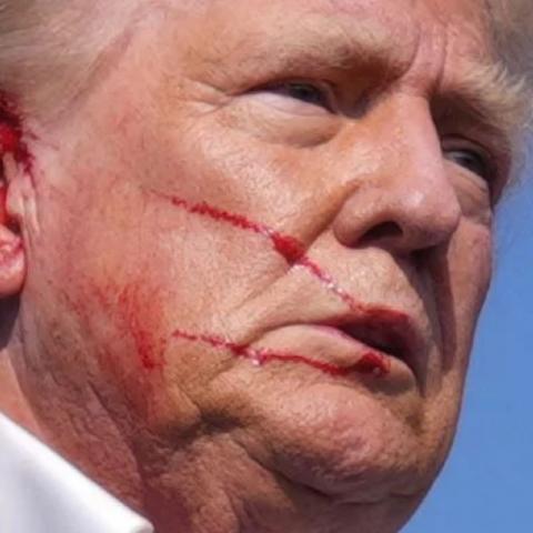 DONALD TRUM, Presultó herido.