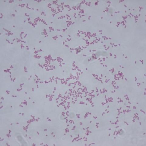 Klebsiella oxytoca