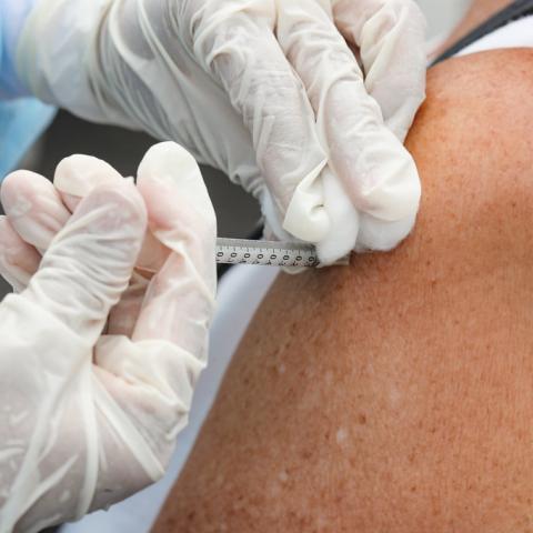 Auge de tosferina y sarampión se relaciona con falta de vacunación: ISSEA