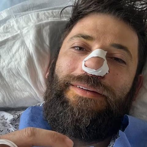 Actor de "Harry Potter" es operado de emergencia tras sufrir crisis respiratoria