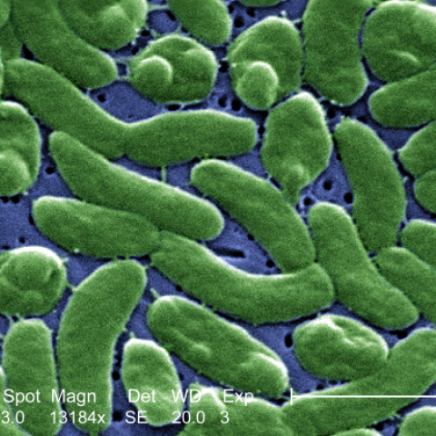 Vibrio vulnificus