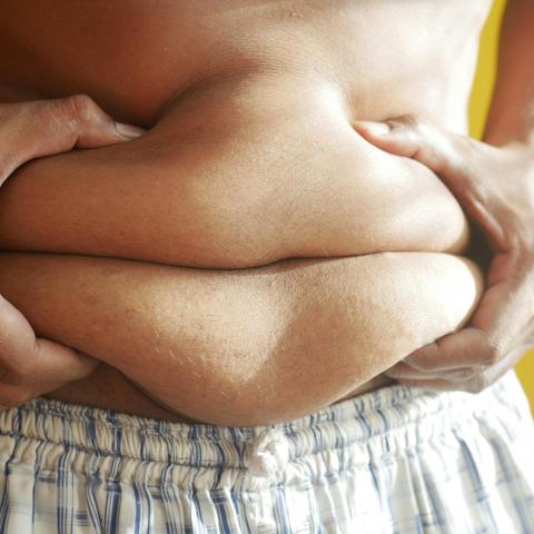 ‘Diabesidad’ está afectando a uno de cada mil aguascalentenses: Colegio de Médicos