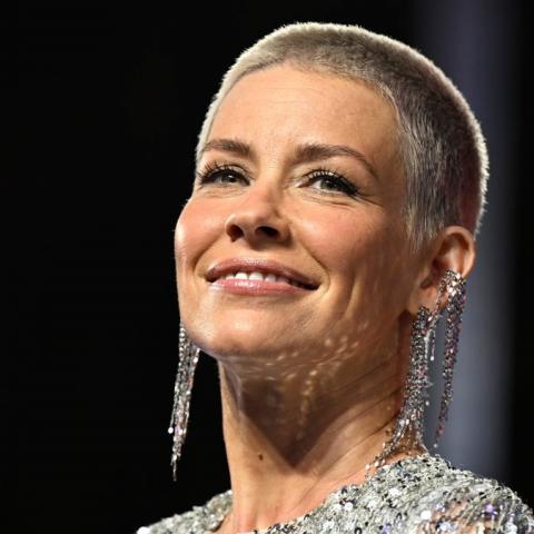 La actriz Evangeline Lilly, de "Avengers", fue diagnosticada con daño cerebral tras fuerte accidente
