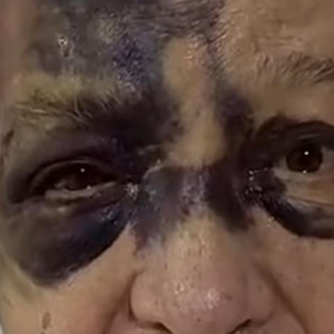 Luis de Alba aparece con fuertes golpes en el rostro