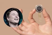 Implantan con éxito el primer chip cerebral Neuralink de Elon Musk