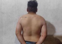 intoxicado 