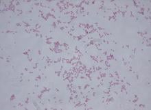 Klebsiella oxytoca