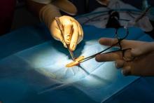 Sólo un centro de salud realiza vasectomía sin bisturí en la capital; es el tercer lugar nacional