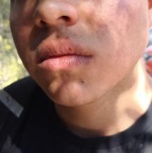 Estudiante lesionado 