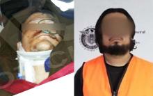 Desde el día 1 la autoridad sabía su nombre porque dejó en el lugar de los hechos su cartera con su identificación