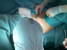 Aguascalientes no cuenta con personal especializado para cirugías de reasignación de sexo: ISSEA