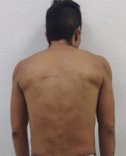 lesiones 