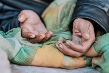 ERRADICACIÓN DE LA POBREZA EXTREMA 